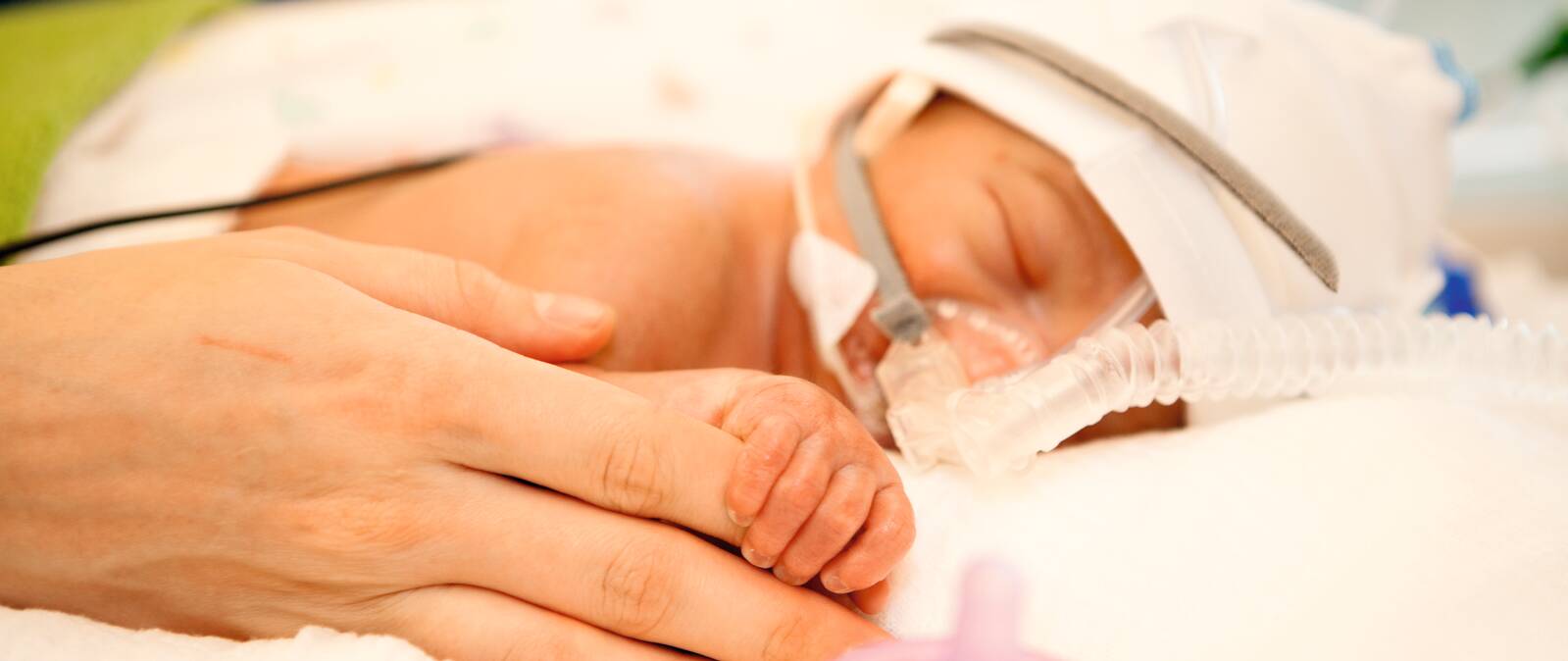 Baby auf der Intensivstation im Ostschweizer Kinderspital